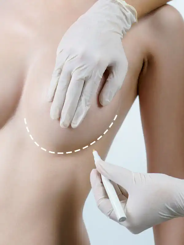 Breast Lifting Breast Lifting